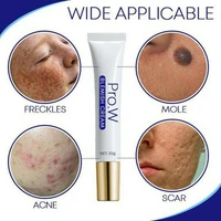 whitening freckle cream remove melasma dark spots lighten melanin melasma remover moisturizing brightening facial skin care 30g