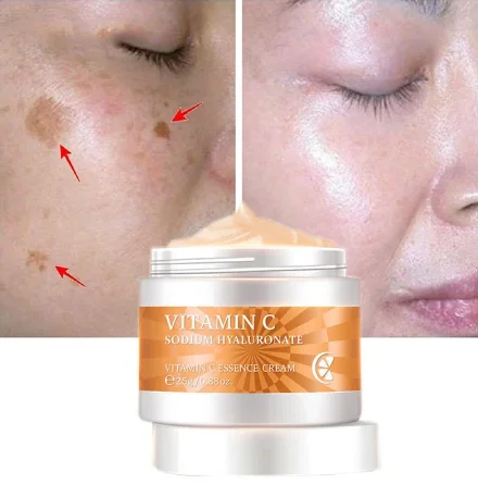 

Vitamin C Whitening Freckle Cream Moisturizer Anti-aging Brighten Remove Face Melasma Dark Spot Melanin Beauty Skin Care Cream