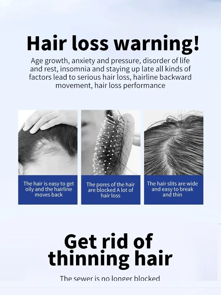 Рост волос для мужчин и женщин имбирное натуральное масло роста уход за волосами