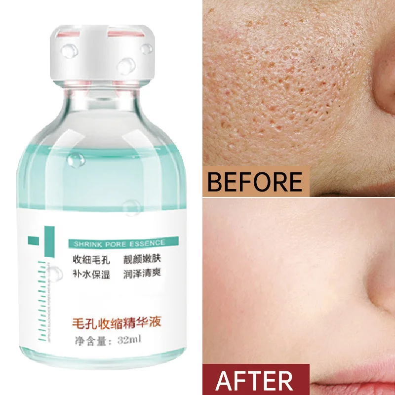 

Shrink Pores Face Serum Hyaluronic Acid Oil Control Brighten Firm Remove Wrinkles Facial Essence Anti-Acne Moisturize Skin Care