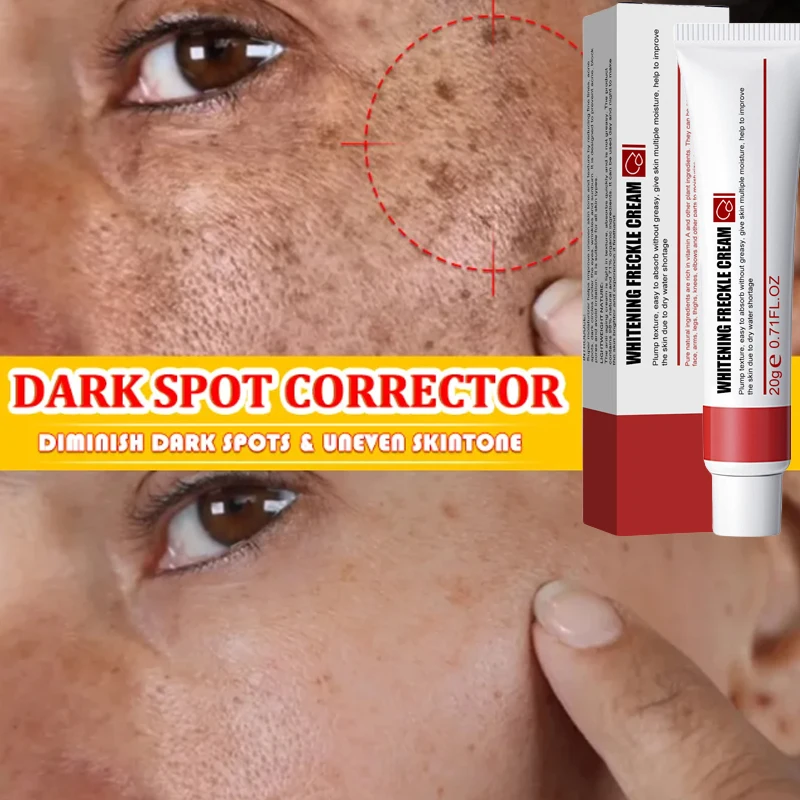 

Whitening Freckle Cream Effective Remove Melasma Melanin Cream Dark Spots Corrector Moisturize Brighten Smooth Face Skin Care