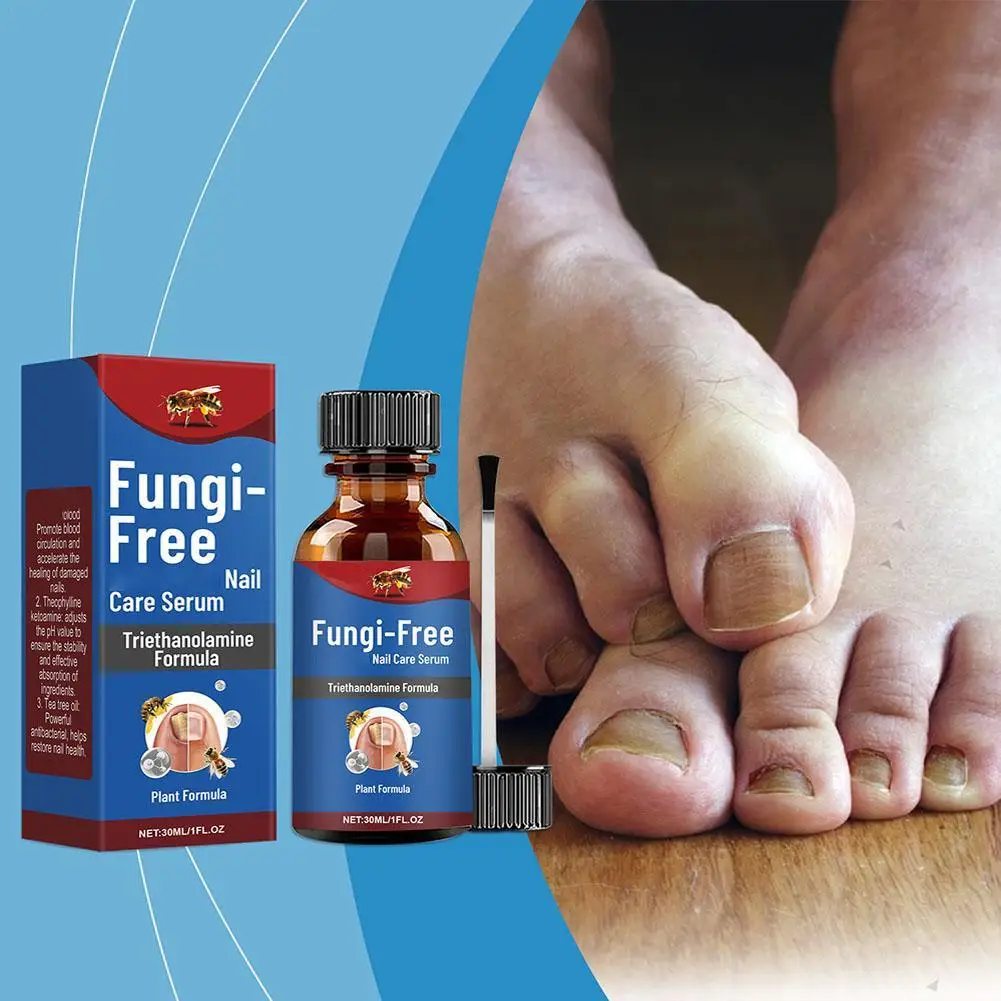 ł na grzybicę paznokci Serum do usuwania grzybów Przeciw infekcjom Paronychia Onychomycosis Paznokcie stóp Produkty pielęgnacji 30 мл