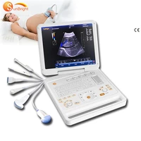 usg 4d cardiac heart surgery professional color doppler ultrasound machine 3d 4d medical sonogram ce ultrasound color