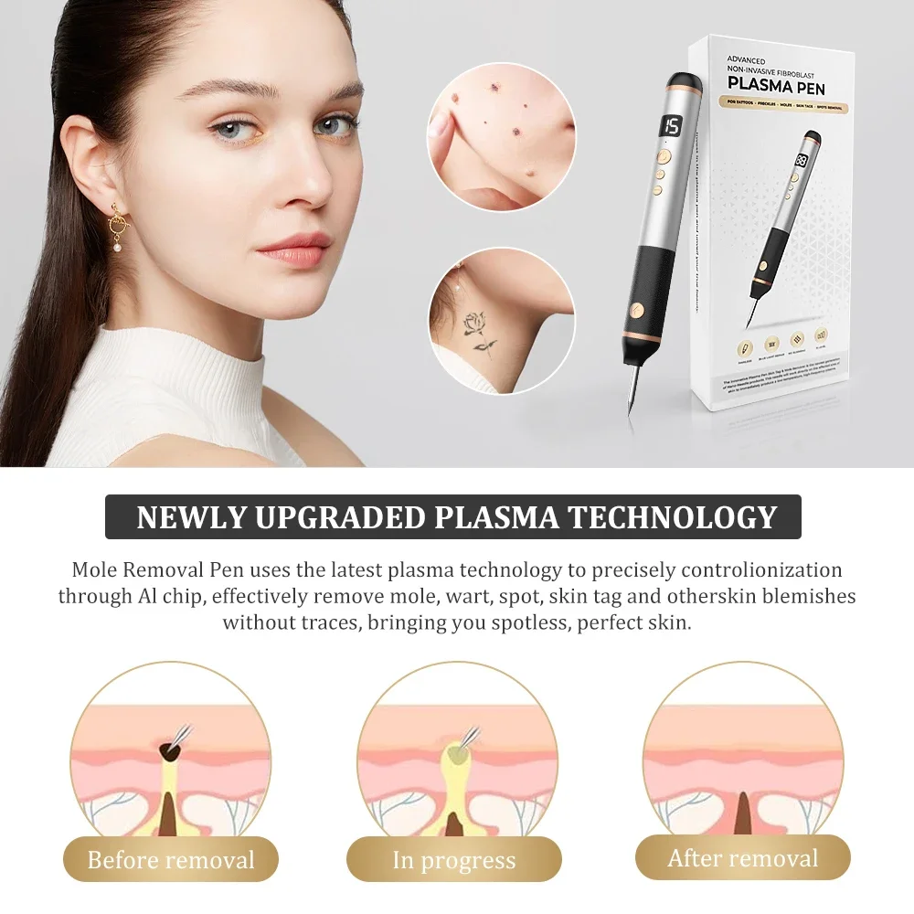 Плазменное удаление бородавок кожи лица электрическое приспособление папилломы