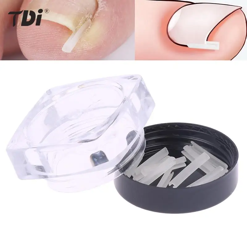 

10PcsPcs Paronychia Treatment Recover Corrector Pedicure Tools Nail Correction Stickers Ingrown Toenail Corrector Patches