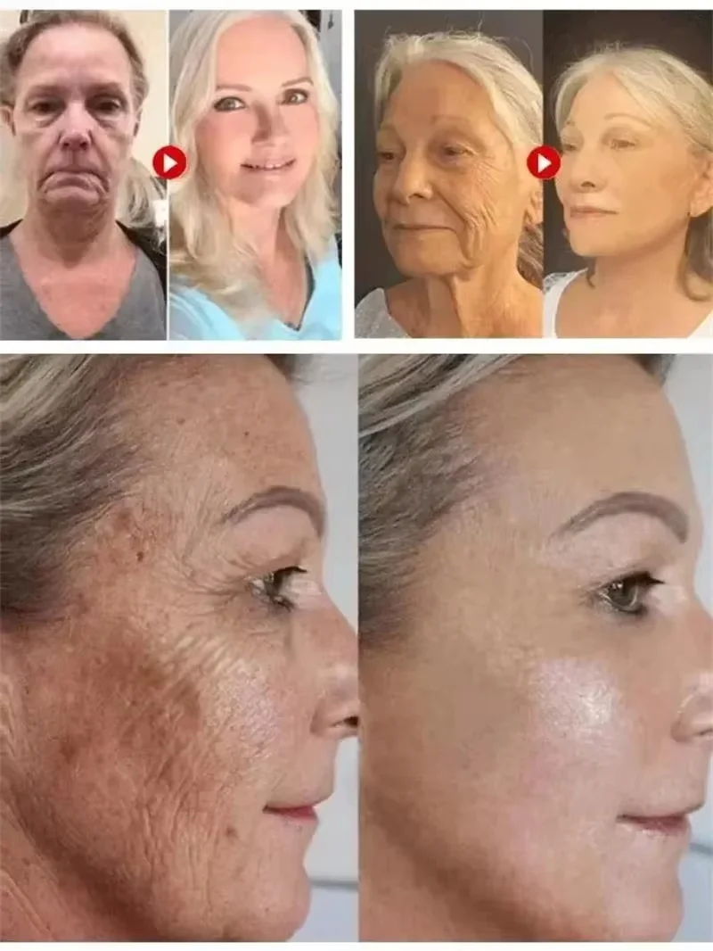 Коллагеновая эссенция для удаления морщин мгновенное укрепляющее лифтинговое