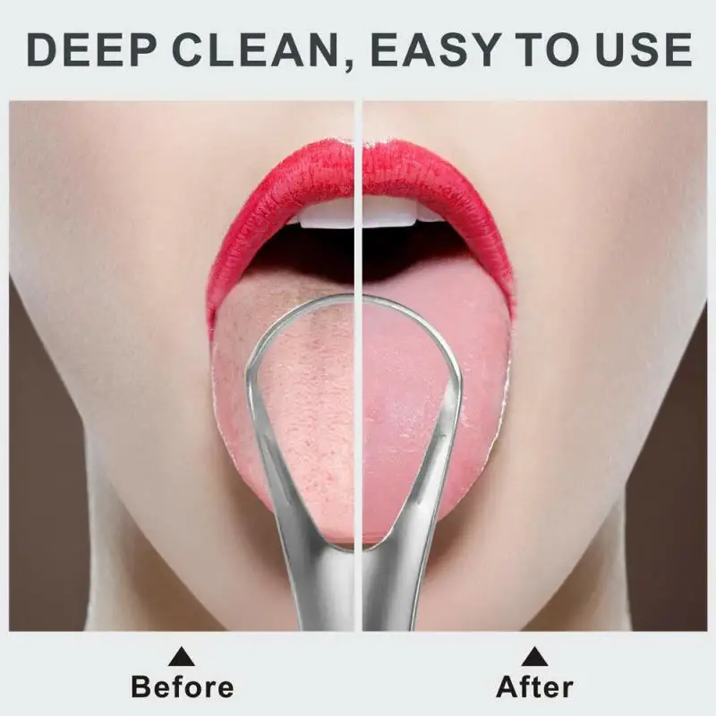 

Stainless Steel Tongue Scarper Cleaners For Oral Hygiene Gratte Langue Tounge Scrapper Toothbrush Tongue Scraper Cleaning Brush