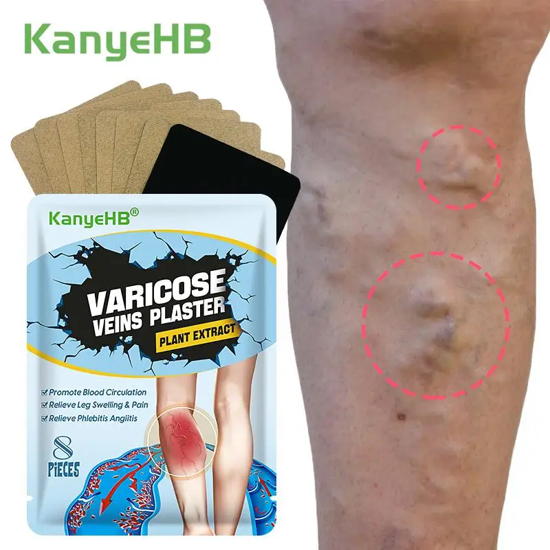 

8Pcs=1Bag Patch For Varicose Veins Effective Varicose Vein Relief Herb Plaster To Relieve Vasculitis Phlebitis Spider Pain W019