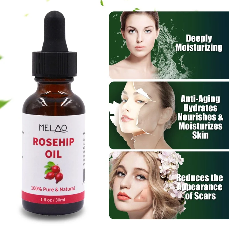 Эфирное масло чистого имбиря для массажа кожи тела 30 мл предотвращает выпадение