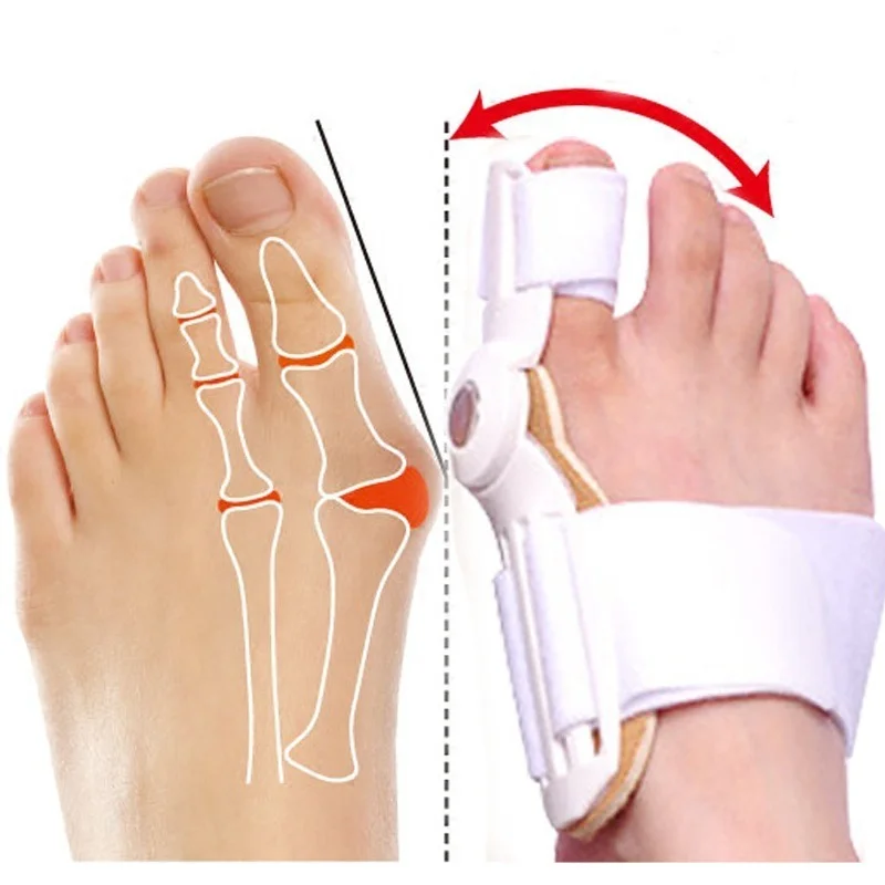 

1Pair=2PCS Hallux Valgus Stretcher Big Toe Bunion Splint Straightener Corrector Foot Pedicure Separator Toes Corrector For Toes