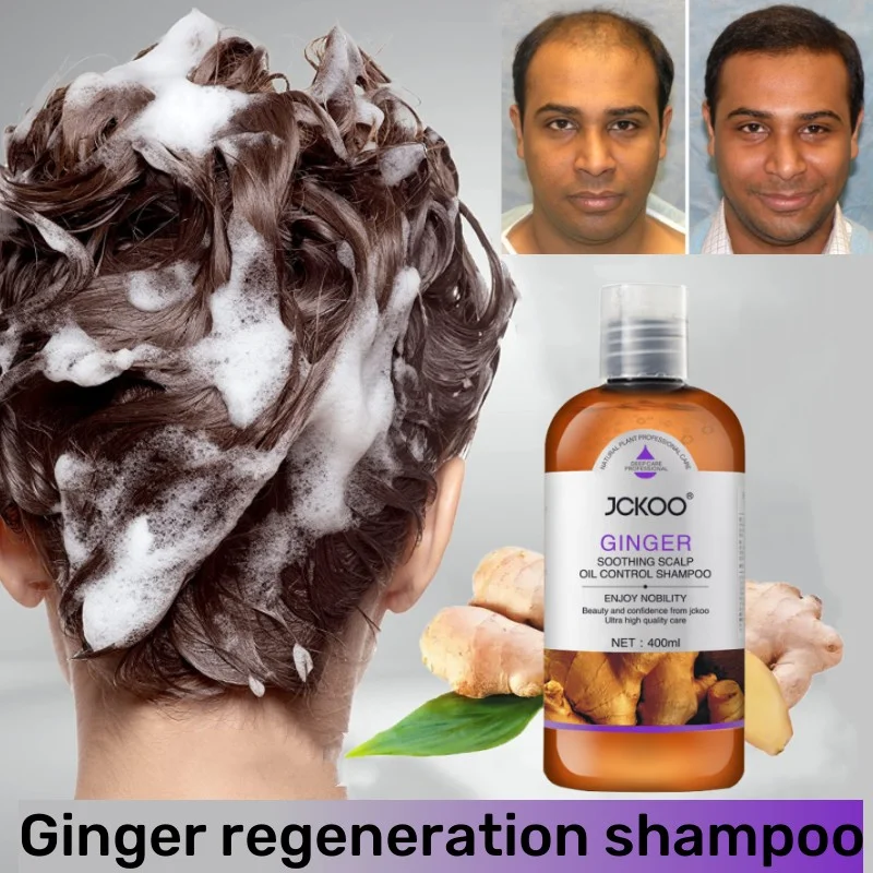 

Natural Ginger Shampoo Promotes Hair Growth Prevents Bald Hair Loss Anti-dandruff Anti-itching Oil Control Cleans Scalp 400ml