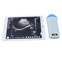 handheld wireless ultrasound scanner 128 element color doppler microconvex ultrasound probe veterinary ultrasound equipment