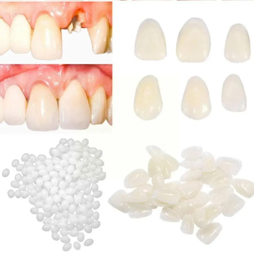 

Resin 5g/10g/15g/20g Temporary Tooth Repair Kit Teeth Teeth Glue Solid FalseTeeth Tooth Denture Adhesive Whitening Gaps Bea Q0E0