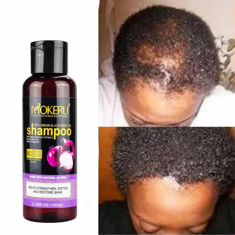 Шампунь для укрепления и восстановления волос с луком розмарином 100 мл