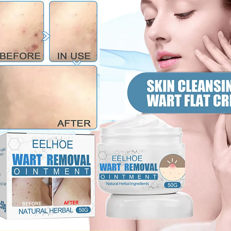 

Skin Tag Remover Painless Mole foot Corn Dark Spot Warts Cream Freckle Face flat Wart Antibacterial Treatment Removal Ointment