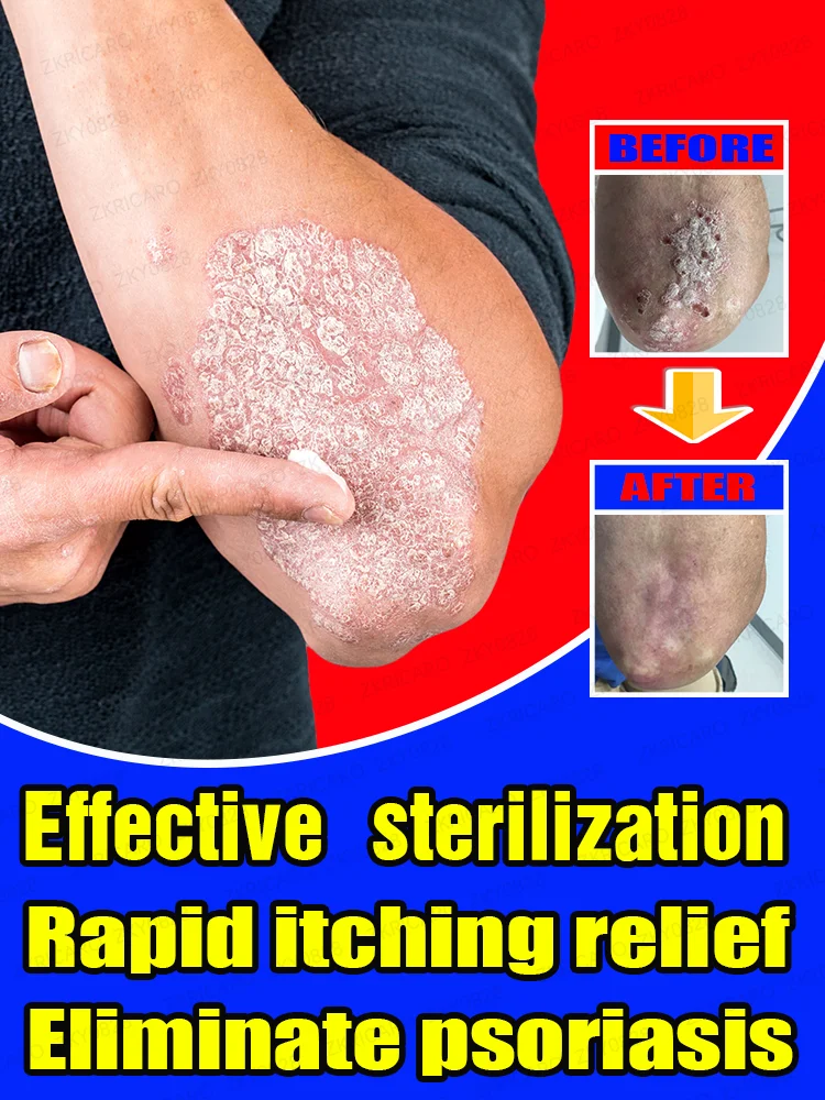 Раскройте жизненную силу кожи и попрощайтесь с покраснениями зудом шелушением.