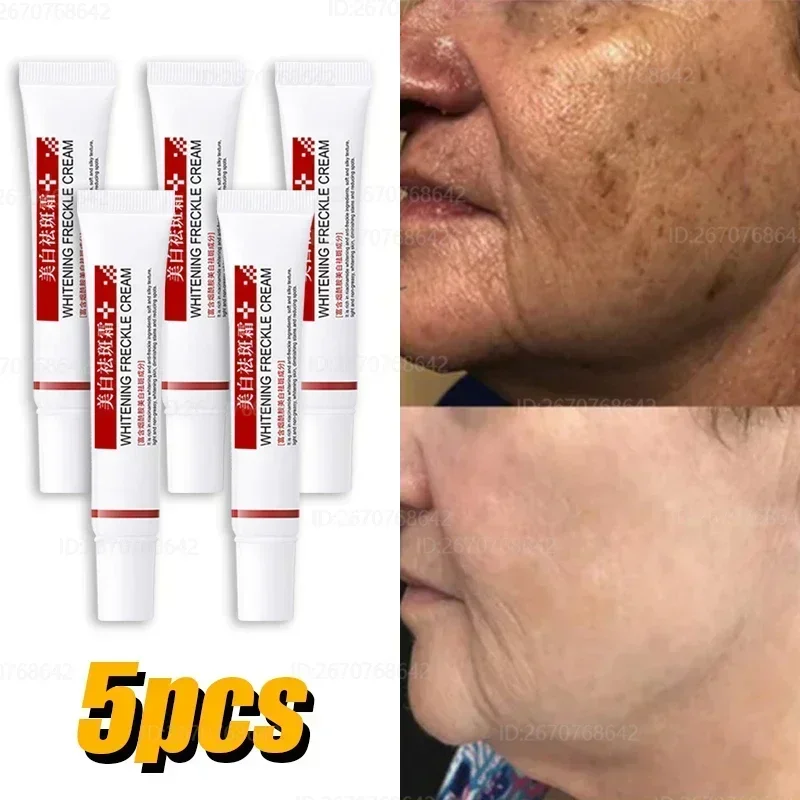 Эффективный точечный крем быстрое отбеливание удаление мелазмы на лице мелазма