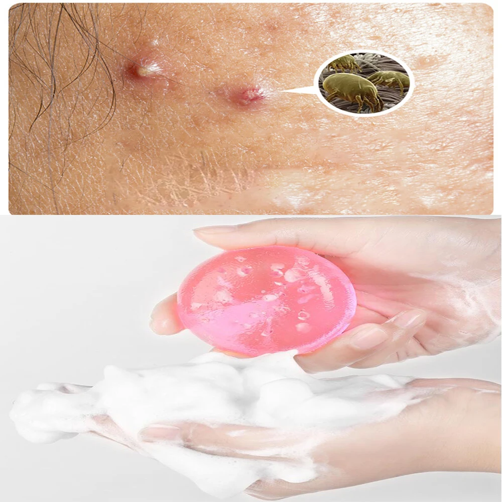 

Removal Mites Sakura Soap Niacinamide Brightening Soap Deep Cleaning Pores Cleansing Bathing Acne Removal Skincare Handmade Soap