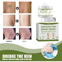 varicose vein relief cream treatment vasculitis phlebitis ointment relief swollen blood vessel medical plaster body care product