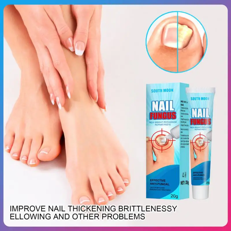 

Effective Nail Therapy Cream Nail Fungus Removal Cream Onychomycosis Paronychia Soft Nail Care Toenail Repair Ointment 20g