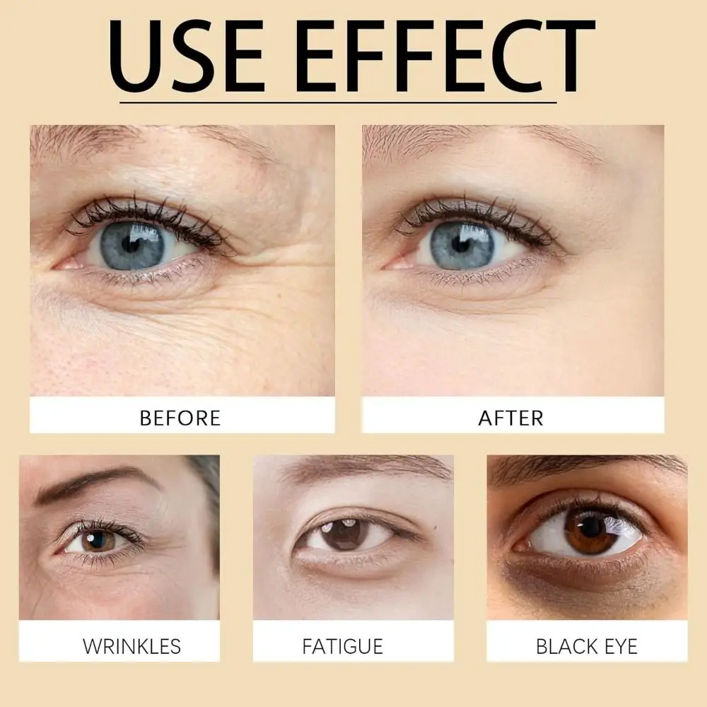 Лидер продаж роликовая Сыворотка для глаз с роликом удаления лазеток средство