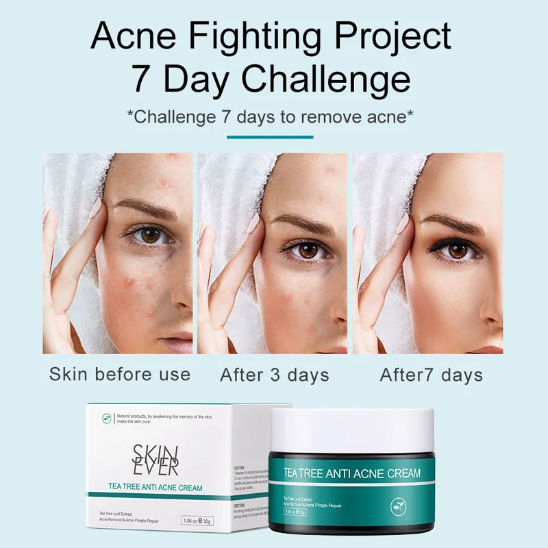

Крем для лечения акне чайного дерева, удаление акне, прыщей, улучшение следов акне, успокаивающий Восстанавливающий контроль жирности, отбе...