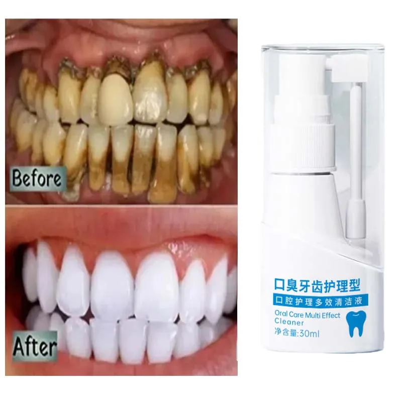 

Teeth Whitening Essence Remove Plaque Stains Oral Hygiene Bleaching Brighten Cleansing Fresh Breath Serum Dentistry Care Product