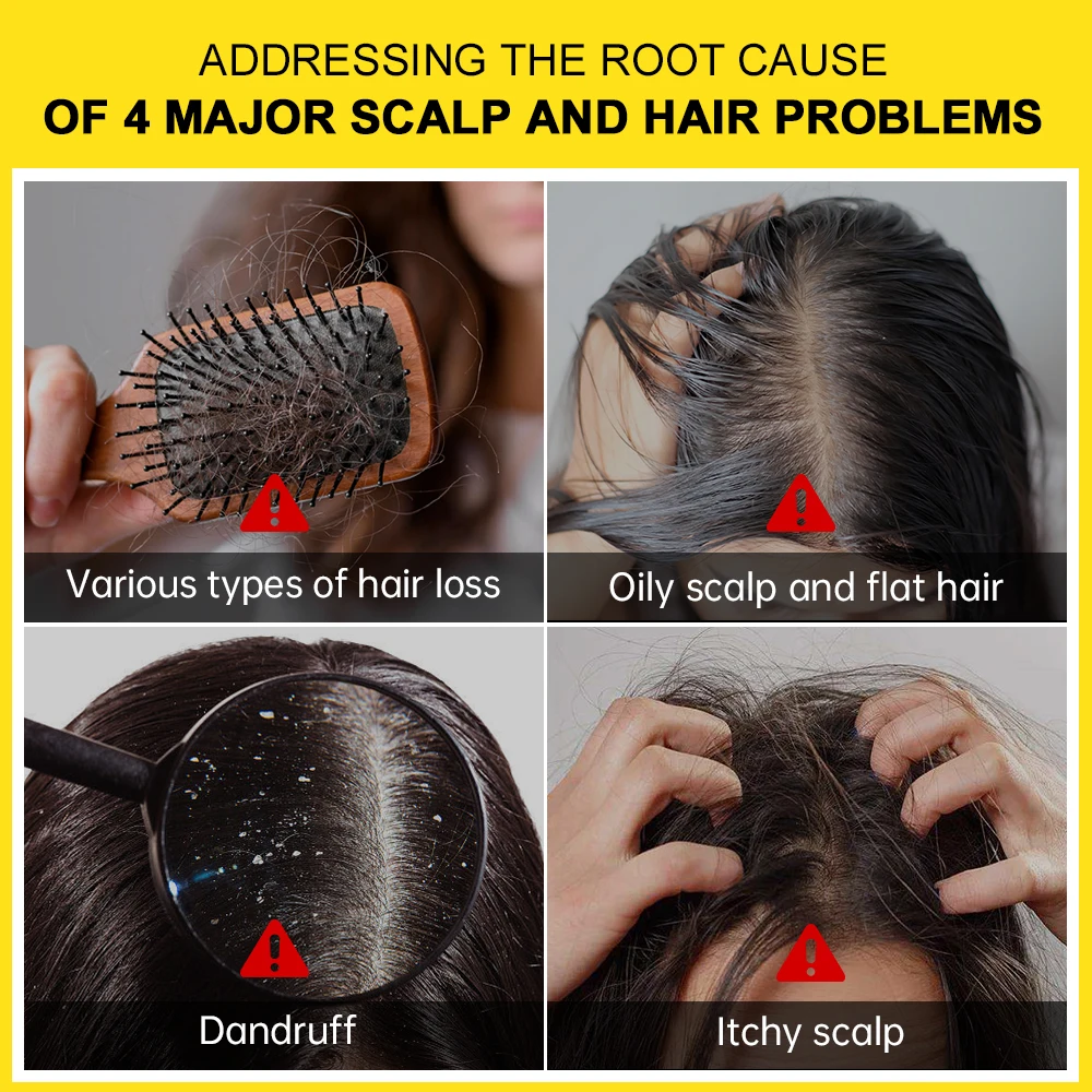 Маска для волос с розмарином против выпадения перхоти имбиря укрепляющая корни