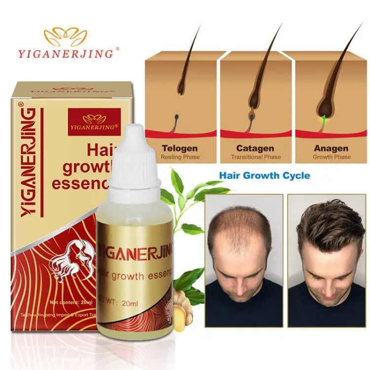 

YIGANERJING Hair Growth Essence Ginger Oil Hair Growth Serum Restoration Hair Loss Dry Frizzy Damaged Liquid Serum Hair Care Oil