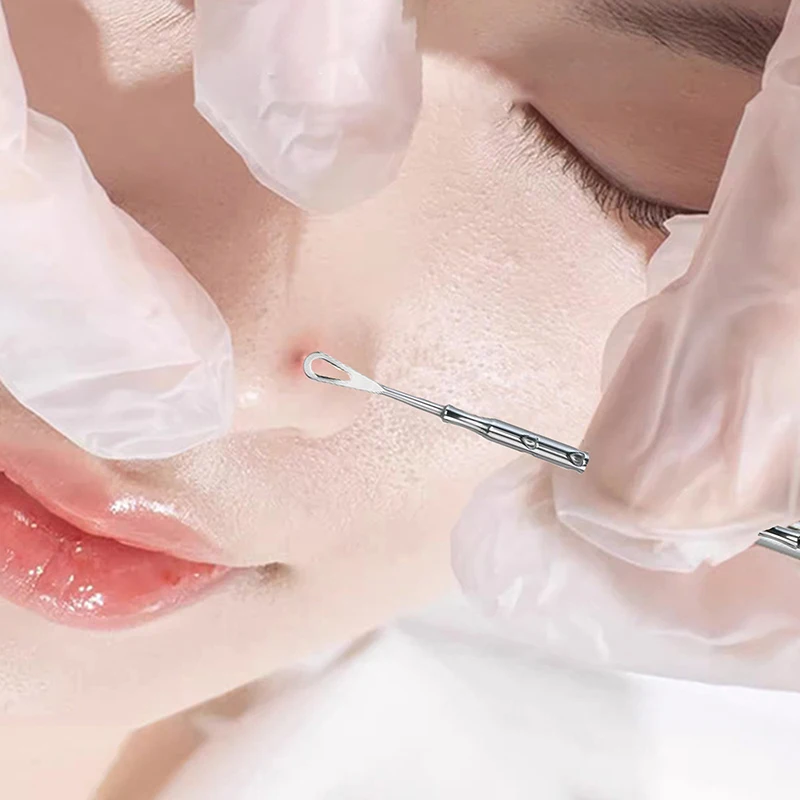 Средство для удаления черных точек инструмент прыщей игла средство комедонов