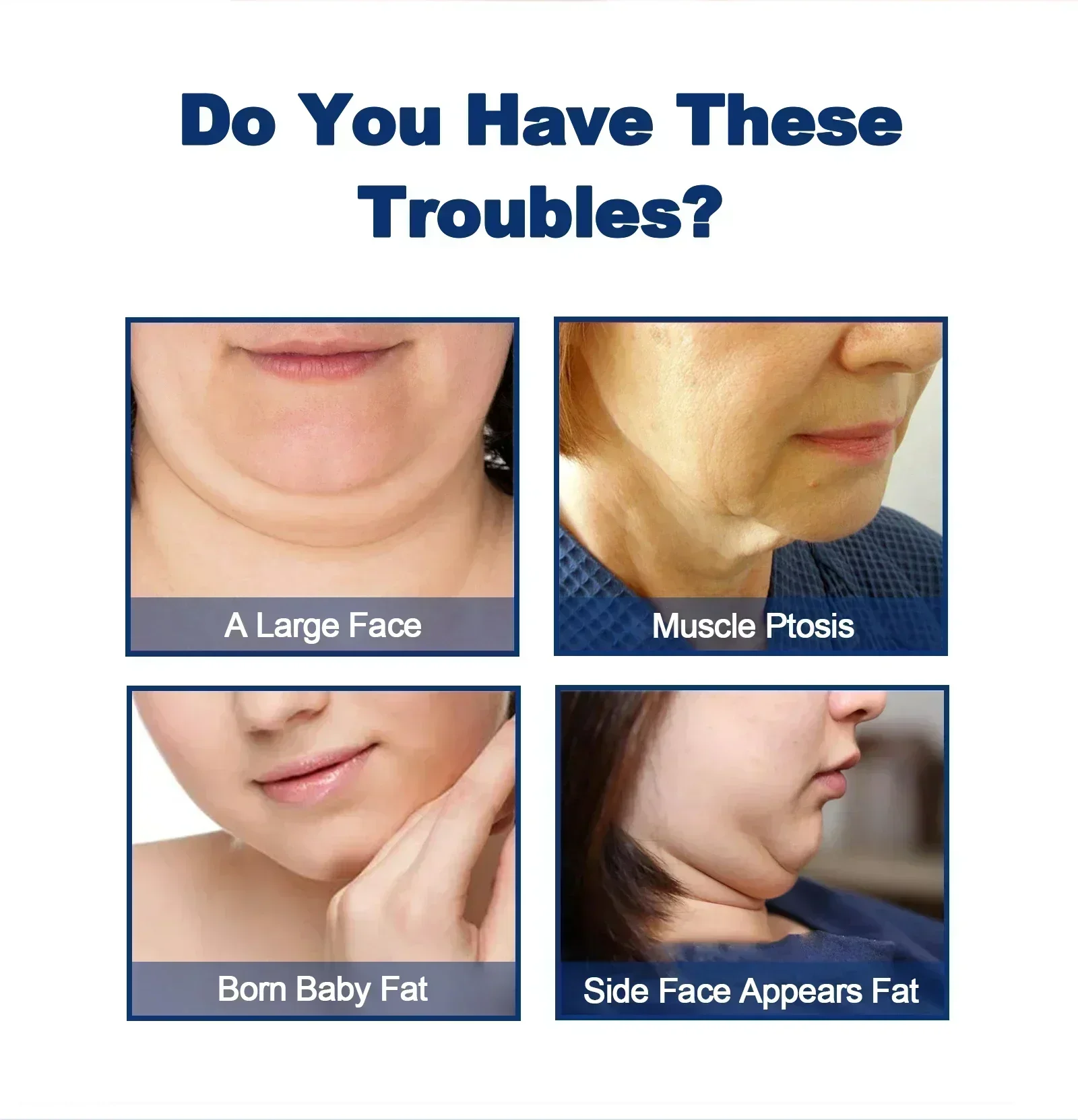 ГОРЯЧАЯ ПРОДАЖА V-образный крем для удаления двойного подбородка укрепляющий