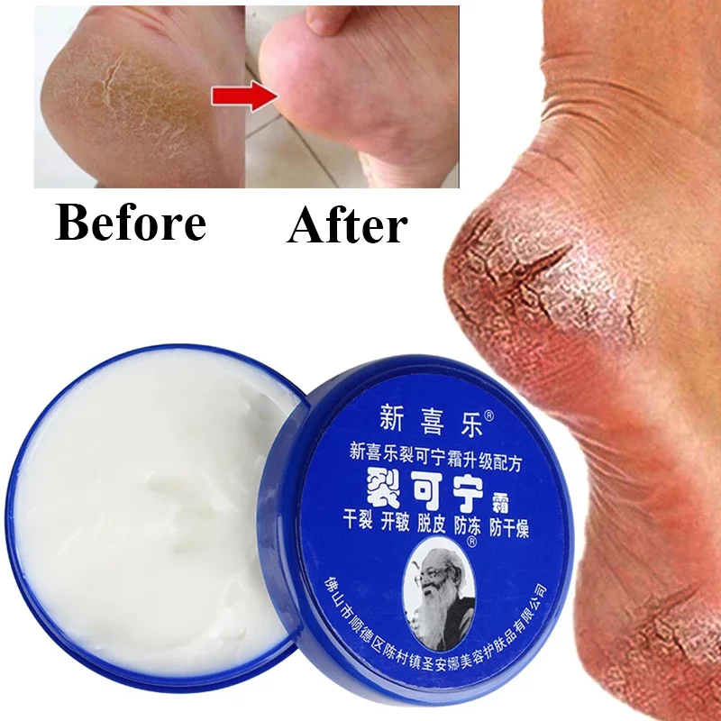 Heel Cracked Repair Cream Removal Dead Skin Moisturizing Han