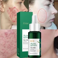 tea tree acne removal serum treatment acne scar shrink pores oil control anti acne fade acne spots pimple whitening skin care