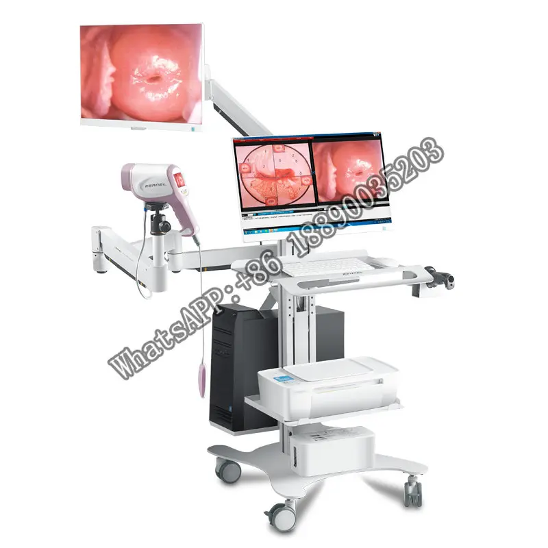 

CE clear colposcope KN-2200I (H) colposcopy cervical cancer screen full hd digital colposcope camera gynecology colposcope