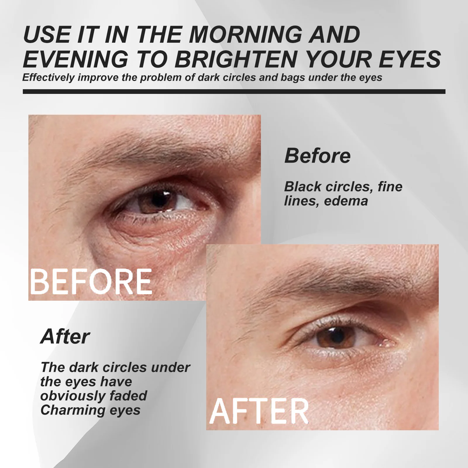 Eye Bag Removal Cream Anti Puffiness Fade Dark Circle Anti Wrinkle Brightening Skin Moisturizing Whitening Men Care Eye Cream