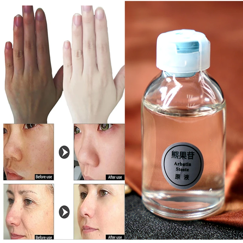 

Arbutin Skin Brightening Essence Liquid For Removing Chloasma Lightening Brightening Serum Kojic Acid Bleaching Cream Dropship