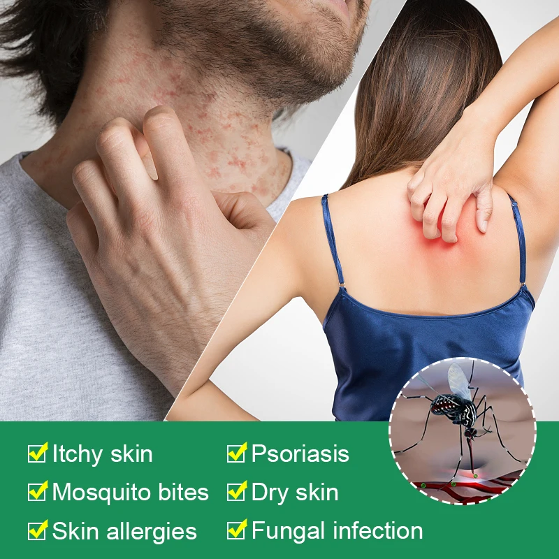 3 шт./лот Таиландские травяные кремы материал от псориаза экземы мазь крем для