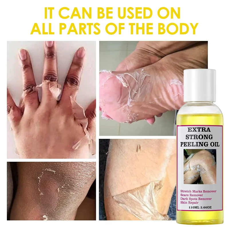 

Extra Strong Yellow Peeling Oil Whitening Peeling Oil Lighten Elbows Knees Hands Melanin Even Skin Tone and Whiten Skin