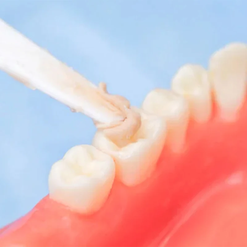 VVDental Стоматологический стеклянный линометр цементный стеклоионный и