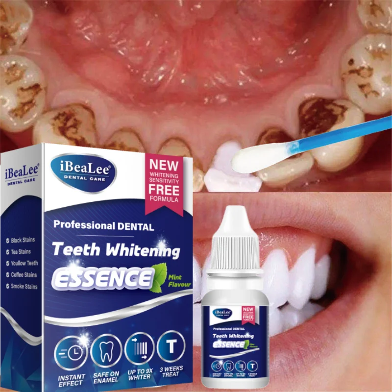 Instant Teeth Whitening Serum Remove Dental Plaque Oral Hygiene Bleaching Products Dental Stains Cleans Essence Gel Care Tools