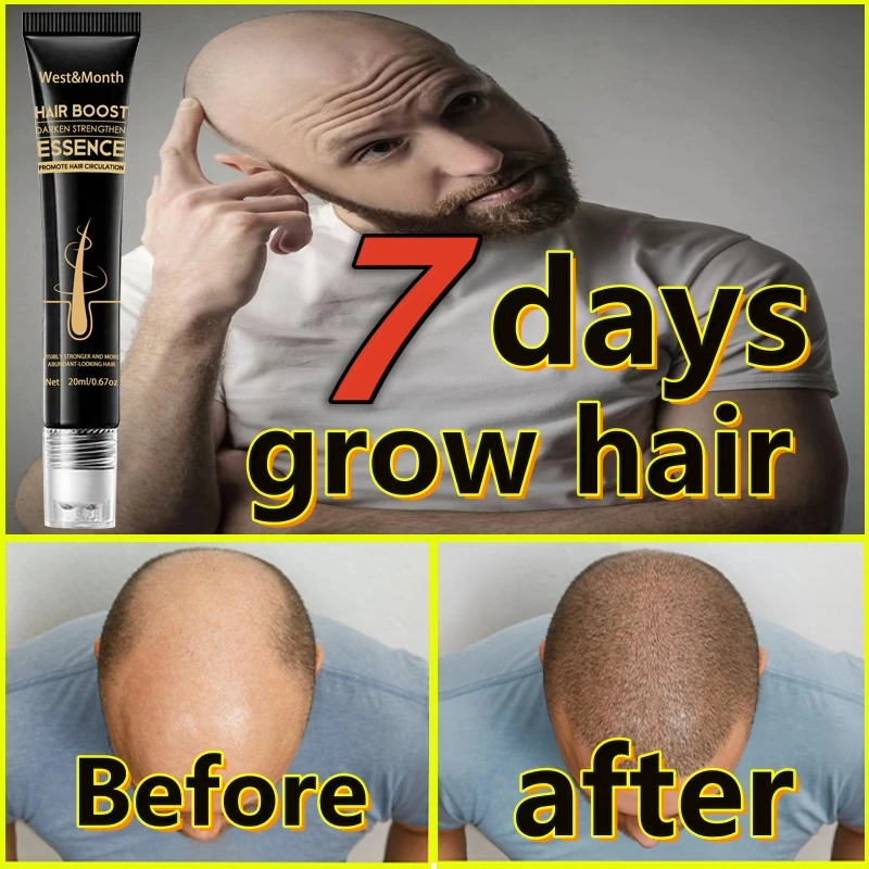 

Fast Hair Growth Essence Effective Anti Hair Loss Serum Baldness Repair Hereditary Postpartum Seborrheic Hair Loss Hair Care
