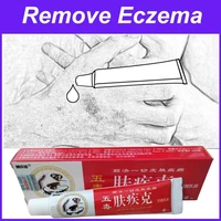 against psoriasis cream natural herbal ointment antibacterial gel anti itch eczematoid urticaria skin treatment fjk