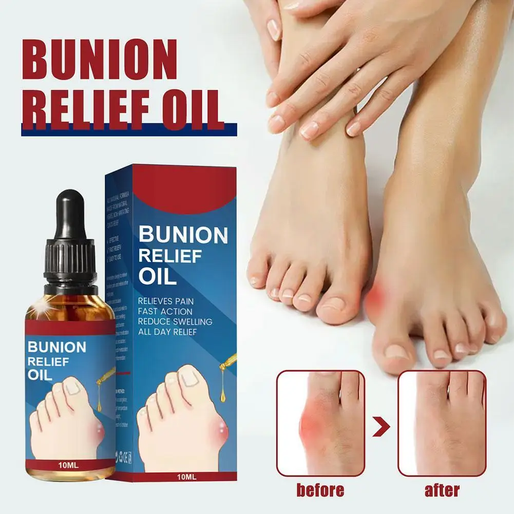 

Средство для лечения Ногтей от грибков, эссенция для восстановления ног, удаления грибка на ногах, антиинфекционный грибковый червяк N H9D5