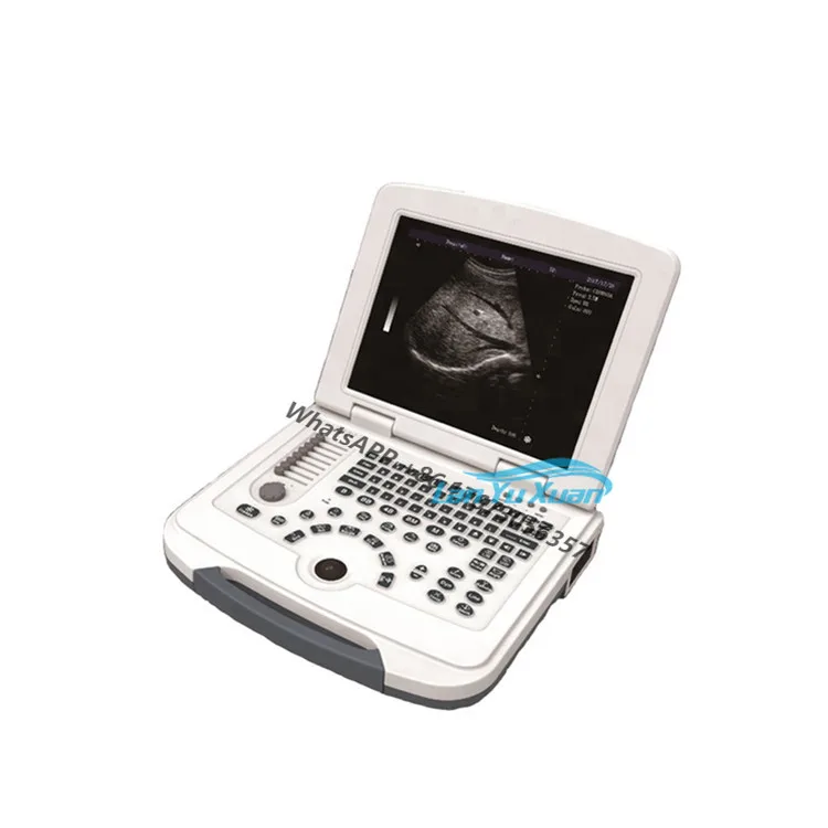 

BT-UD580 Cheap Medical Portable Black and White Ultrasound Machine Ultrasound Scanner for Human Use Price
