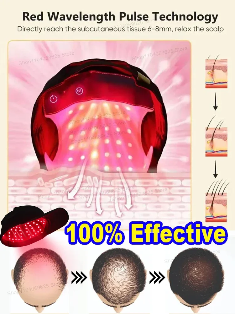 Экспозиция à la lumière rouge and blue plus de calvitie