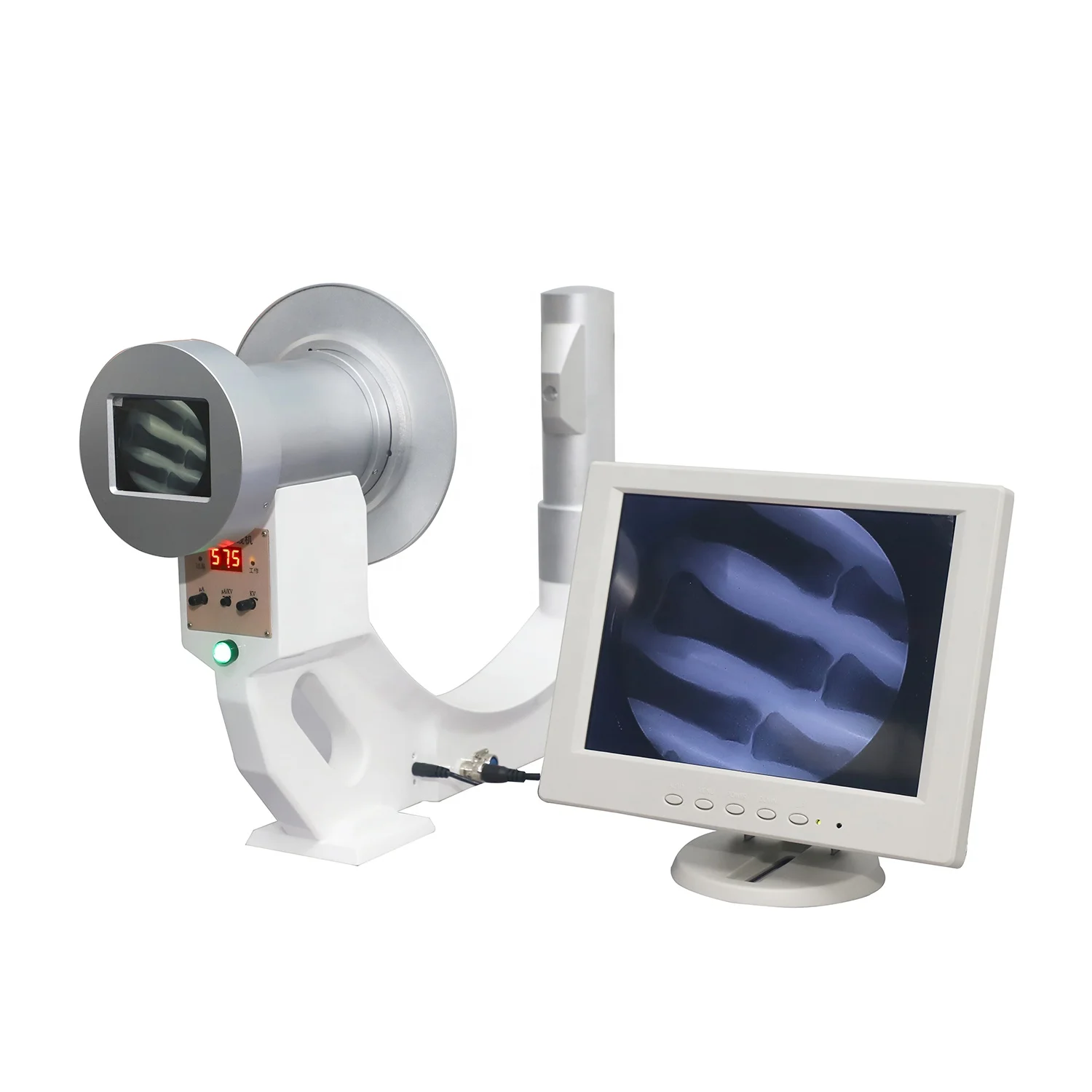 

Intelligent Portable Digital X-ray Machine with High Frequency Medical Diagnostic Equipment