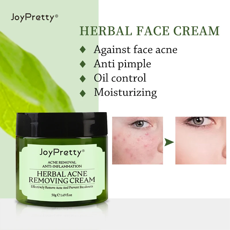 

JoyPretty Herbal Day Cream For Acne Skin Care Face Moisturizer Oil Control Pimple Acne Scar Removal Cream Treatment For Women