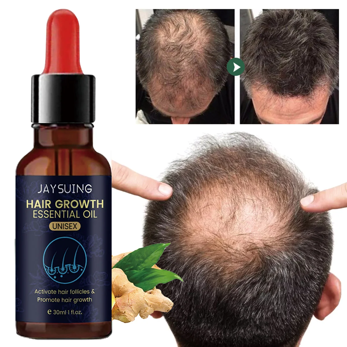Ginger Hair Growth Products Prevent Hair Loss Essential Oil Fast Growing Anti-Drying Scalp Treatment Beauty Health for Men Women