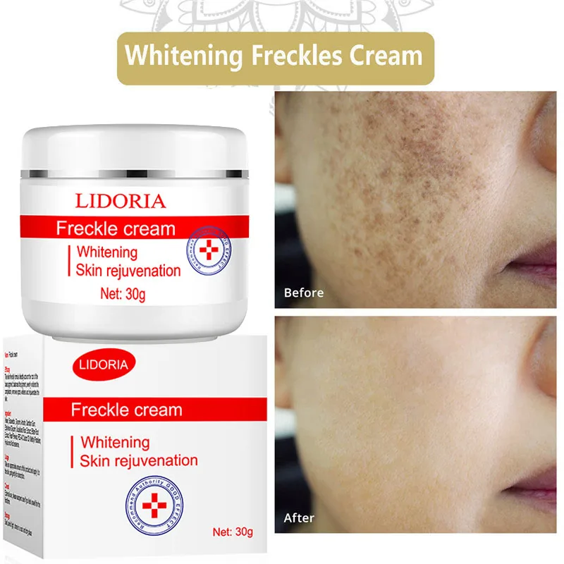 Крем для отбеливания веснушек выцветание темных пятен солнцезащитные пятна