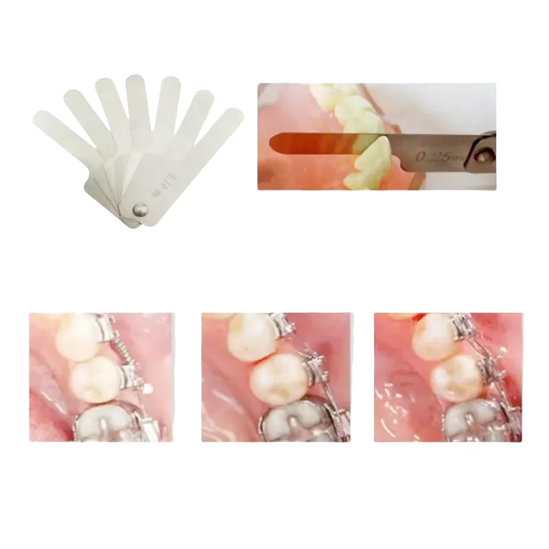 7 шт./набор Стоматологические Ортодонтические линейки для снижения